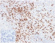 IHC staining of FFPE human spleen tissue with Lysozyme C antibody (clone LYZ/3944). Negative control inset: PBS instead of primary antibody to control for secondary binding. HIER: boil tissue sections in pH 9 10mM Tris with 1mM EDTA for 20 min and allow to cool before testing.