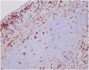 IHC staining of FFPE human spleen tissue with Lysozyme C antibody (clone LYZ/3944). HIER: boil tissue sections in pH 9 10mM Tris with 1mM EDTA for 20 min and allow to cool before testing.