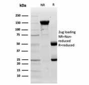 SDS-PAGE analysis of purified, BSA-free Lysozyme C antibody (clone LYZ/3944) as confirmation of integrity and purity.