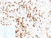 IHC staining of FFPE human spleen tissue with LYZ antibody (clone LYZ/3947). Negative control inset: PBS instead of primary antibody to control for secondary binding. HIER: boil tissue sections in pH 9 10mM Tris with 1mM EDTA for 20 min and allow to cool before testing.
