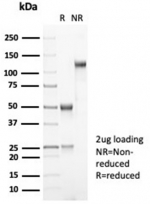 SDS-PAGE analysis of purified, BSA-free recombinant MDM2 antibody (clone MDM2/7061R) as confirmation of integrity and purity.