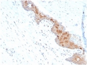 IHC staining of FFPE human prostate tissue with Macrophage Migration Inhibitory Factor antibody (clone MIF/4336). HIER: boil tissue sections in pH 9 10mM Tris with 1mM EDTA for 20 min and allow to cool before testing.