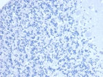 Negative control: IHC staining of FFPE human brain tissue with Neprilysin antibody (clone MME/6461) at 2ug/ml in PBS for 30min RT. HIER: boil tissue sections in pH 9 10mM Tris with 1mM EDTA for 20 min and allow to cool before testing.