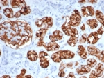 IHC staining of FFPE human kidney tissue with Neprilysin antibody (clone MME/6461). HIER: boil tissue sections in pH 9 10mM Tris with 1mM EDTA for 20 min and allow to cool before testing.