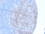 IHC staining of FFPE human tonsil tissue with Neprilysin antibody (clone MME/6461). HIER: boil tissue sections in pH 9 10mM Tris with 1mM EDTA for 20 min and allow to cool before testing.