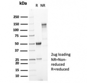 SDS-PAGE analysis of purified, BSA-free recombinant Gastric Mucin antibody (clone MUC5AC/7067R) as confirmation of integrity and purity.