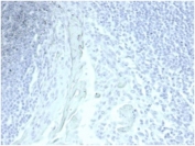 Negative control: IHC staining of FFPE human tonsil tissue with recombinant Gastric Mucin antibody (MUC5AC/7067R) at 2ug/ml in PBS for 30min RT. HIER: boil tissue sections in pH 9 10mM Tris with 1mM EDTA for 20 min and allow to cool before testing.