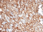 IHC staining of FFPE human spleen tissue with PIK3 antibody (clone PIK3R2/292). HIER: boil tissue sections in pH 9 10mM Tris with 1mM EDTA for 20 min and allow to cool before testing.