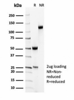 SDS-PAGE analysis of purified, BSA-free recombinant SMMHC antibody (clone MYH11/7087R) as confirmation of integrity and purity.
