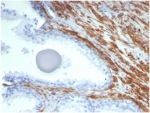 IHC staining of FFPE human prostate tissue with recombinant SMMHC antibody MYH11/7087R). HIER: boil tissue sections in pH 9 10mM Tris with 1mM EDTA for 20 min and allow to cool before testing.
