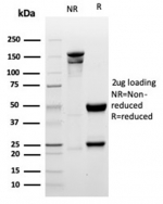 SDS-PAGE analysis of purified, BSA-free recombinant Myogenin antibody (clone MYOG/6298R) as confirmation of integrity and purity.
