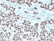 IHC staining of FFPE human lung tissue with NFIA antibody (clone PCRP-NFIA-2C6). HIER: boil tissue sections in pH 9 10mM Tris with 1mM EDTA for 20 min and allow to cool before testing.