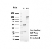 SDS-PAGE analysis of purified, BSA-free recombinant NPM1 antibody as confirmation of integrity and purity.