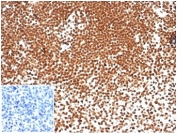 IHC staining of FFPE human tonsil tissue with recombinant NPM1 antibody. Negative control inset: PBS instead of primary antibody to control for secondary binding. HIER: boil tissue sections in pH 9 10mM Tris with 1mM EDTA for 20 min and allow to cool before testing.