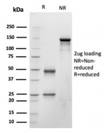 SDS-PAGE analysis of purified, BSA-free BNP antibody (clone NPPB/4493) as confirmation of integrity and purity.