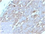 IHC staining of FFPE human heart tissue with BNP antibody (clone NPPB/4493). Negative control inset: PBS instead of primary antibody to control for secondary binding. HIER: boil tissue sections in pH 9 10mM Tris with 1mM EDTA for 20 min and allow to cool before testing.