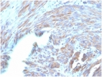 IHC staining of FFPE human uterus with BNP antibody (clone NPPB/4493). HIER: boil tissue sections in pH 9 10mM Tris with 1mM EDTA for 20 min and allow to cool before testing.