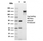 SDS-PAGE analysis of purified, BSA-free recombinant Ornithine Decarboxylase antibody (clone rODC1/487) as confirmation of integrity and purity.