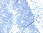 IHC staining of FFPE human lymph node tissue with GMNN antibody (clone GMNN/4033). HIER: boil tissue sections in pH 9 10mM Tris with 1mM EDTA for 20 min and allow to cool before testing.