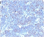 IHC staining of FFPE human thymus with Geminin antibody (clone GMNN/4033). HIER: boil tissue sections in pH 9 10mM Tris with 1mM EDTA for 20 min and allow to cool before testing.