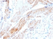 IHC staining of FFPE human bladder tissue with Phosphoglucomutase 5 antibody (clone PGM5/3552) at 2ug/ml. HIER: boil tissue sections in pH 9 10mM Tris with 1mM EDTA for 20 min and allow to cool before testing.
