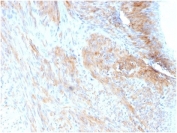 IHC staining of FFPE human uterus with Phosphoglucomutase 5 antibody (clone PGM5/3552)at 2ug/ml. HIER: boil tissue sections in pH 9 10mM Tris with 1mM EDTA for 20 min and allow to cool before testing.