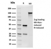 SDS-PAGE analysis of purified, BSA-free Phosphoglucomutase 5 antibody (clone PGM5/3552) as confirmation of integrity and purity.