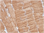 IHC staining of FFPE human skeletal muscle with Skeletal Muscle Actin alpha 1 antibody (clone ACTA1/360). HIER: boil tissue sections in pH 9 10mM Tris with 1mM EDTA for 20 min and allow to cool before testing.