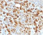IHC staining of FFPE human pancreatic tissue with SERPINA3 antibody (clone AACT/1451 + AACT/1452). HIER: boil tissue sections in pH 9 10mM Tris with 1mM EDTA for 20 min and allow to cool before testing.