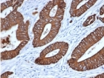 IHC staining of FFPE human colon tissue with Pan Cytokeratin antibody (clone MonoPoly/7249R). HIER: boil tissue sections in pH 9 10mM Tris with 1mM EDTA for 20 min and allow to cool before testing.