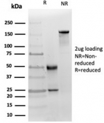 SDS-PAGE analysis of purified, BSA-free MICA antibody (clone MICA/4442) as confirmation of integrity and purity.