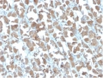 IHC staining of FFPE human stomach with MICA antibody (clone MICA/4442). HIER: boil tissue sections in pH 9 10mM Tris with 1mM EDTA for 20 min and allow to cool before testing.