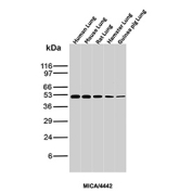 MICA Antibody Lung Tissue WB. Western blot analysis of MHC class I polypeptide-related sequence A (MICA) expression across multi-species lung tissue lysates using MICA antibody clone MICA/4442. Lane 1: human lung lysate, Lane 2: mouse lung lysate, Lane 3: rat lung lysate, Lane 4: hamster lung lysate, Lane 5: guinea pig lung lysate. A band is detected at approximately 50-65 kDa, consistent with glycosylated forms of MICA. The consistent detection across species supports the use of this antibody for cross-species reactivity applications, reflecting conserved expression and post-translational processing of MICA in lung tissue.