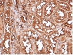 IHC staining of FFPE human kidney tissue with MICA antibody (clone MICA/4443). HIER: boil tissue sections in pH 9 10mM Tris with 1mM EDTA for 20 min and allow to cool before testing.