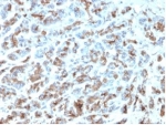 IHC staining of FFPE human stomach with MICA antibody (clone MICA/4443). HIER: boil tissue sections in pH 9 10mM Tris with 1mM EDTA for 20 min and allow to cool before testing.