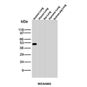 MICA Antibody Human Lung WB. Western blot analysis of MHC class I polypeptide-related sequence A (MICA) expression in multi-species lung tissue lysates using MICA antibody clone MICA/4443. Lane 1: human lung lysate, Lane 2: mouse lung lysate, Lane 3: rat lung lysate, Lane 4: hamster lung lysate, Lane 5: guinea pig lung lysate. A distinct band is detected at approximately 50-60 kDa in human lung lysate, consistent with glycosylated forms of MICA. Minimal or no detectable signal is observed in the non-human lanes under these conditions, supporting a human tissue-enriched detection profile for this clone.