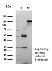 SDS-PAGE analysis of purified, BSA-free MICA antibody (MICA/4443) as confirmation of integrity and purity.