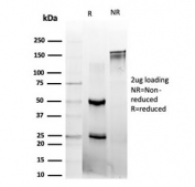 SDS-PAGE analysis of purified, BSA-free L-Myc antibody (clone PCRP-MYCL-2D5) as confirmation of integrity and purity.