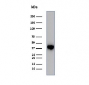 Western blot testing of human PC3 cell lysate using MASPIN antibody (clone SERPINB5/4975). Predicted molecular weight: 42~45 kDa.
