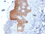 IHC staining of FFPE human skin tissue with MASPIN antibody (clone SERPINB5/4975). Negative control inset: PBS instead of primary antibody to control for secondary binding. HIER: boil tissue sections in pH 9 10mM Tris with 1mM EDTA for 20 min and allow to cool before testing.