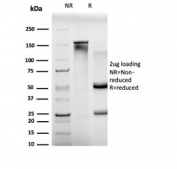 SDS-PAGE analysis of purified, BSA-free BCL11A antibody (clone PCRP-BCL11A-1G10) as confirmation of integrity and purity.