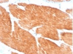 IHC staining of FFPE human bladder tissue with PIK3R2 antibody (clone PIK3R2/1293). HIER: boil tissue sections in pH 9 10mM Tris with 1mM EDTA for 20 min and allow to cool before testing.