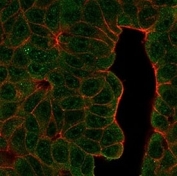 Immunofluorescent staining of PFA-fixed human MCF-7 cells using B-cell lymphoma/leukemia 11A antibody (green, clone PCRP-BCL11A-1H3) and phalloidin (red).