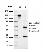 SDS-PAGE analysis of purified, BSA-free Migfilin-1 antibody (clone FBLIM1/4600) as confirmation of integrity and purity.