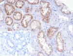 IHC staining of FFPE human kidney tissue with recombinant RBP4 antibody (clone rRBP4/7372). Negative control inset: PBS instead of primary antibody to control for secondary binding. HIER: boil tissue sections in pH 9 10mM Tris with 1mM EDTA for 20 min and allow to cool before testing.