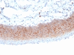IHC staining of FFPE human tonsil tissue with Syndecan-1 antibody (clone SDC1/7180). HIER: boil tissue sections in pH 9 10mM Tris with 1mM EDTA for 20 min and allow to cool before testing.