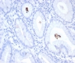 IHC staining of FFPE H. pylori-infected human stomach tissue with Helicobacter pylori antibody (clone HPYL/7225). HIER: boil tissue sections in pH 9 10mM Tris with 1mM EDTA for 20 min and allow to cool before testing.