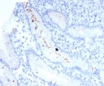IHC staining of FFPE human H. pylori-infected stomach with Helicobacter pylori (clone HPYL/7225) antibody (clone HPYL/7225). HIER: boil tissue sections in pH 9 10mM Tris with 1mM EDTA for 20 min and allow to cool before testing.