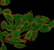 Immunofluorescent staining of PFA-fixed human HeLa cells using Serum Response Factor antibody (green, clone PCRP-SRF-1F7) and phalloidin (red).