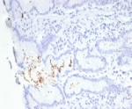 IHC staining of FFPE H. pylori-infected human stomach tissue with Helicobacter pylori antibody (clone HPYL/7229). HIER: boil tissue sections in pH 9 10mM Tris with 1mM EDTA for 20 min and allow to cool before testing.